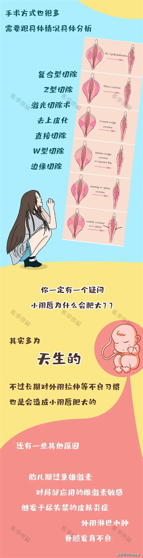 女生下面形狀